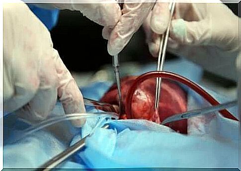 Artificial heart for patients who cannot find an organ donor