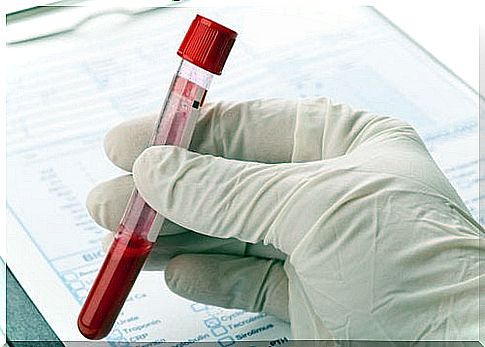 Reagent tube for blood test