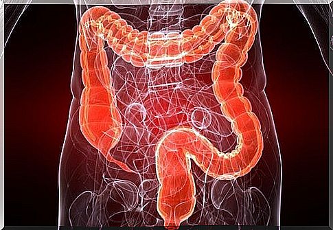 Colitis - What Can I Do?