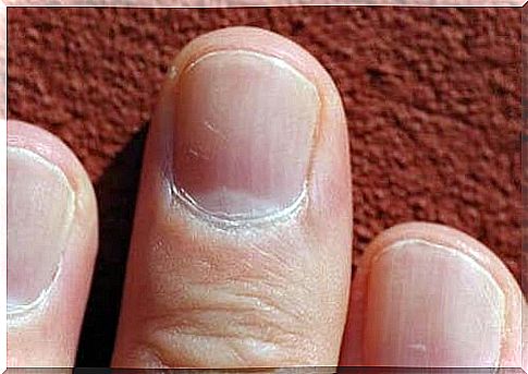 Fingernails: what you can see on them