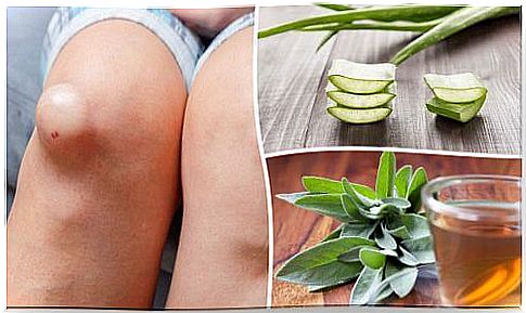 Fluid in the knee: 5 natural anti-inflammatory remedies