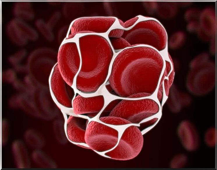 What diseases are associated with a blood clotting disorder?