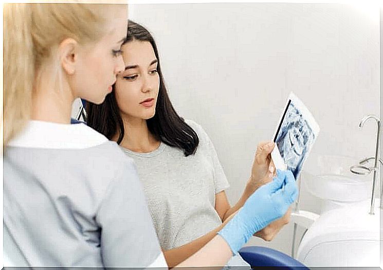 Two doctors look at X-ray with hyperdontia