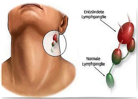 Inflammation of the ganglia: causes and treatment options