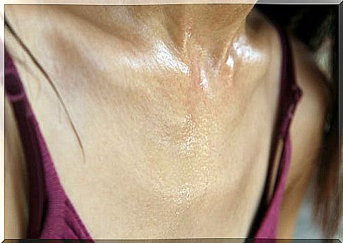 excessive sweating