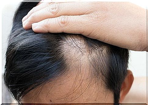 Natural hair loss help