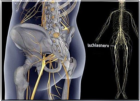 Sciatic pain: tips and treatment options