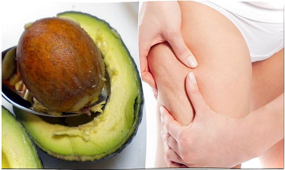 Simple and Effective Home Remedies for Cellulite Removal