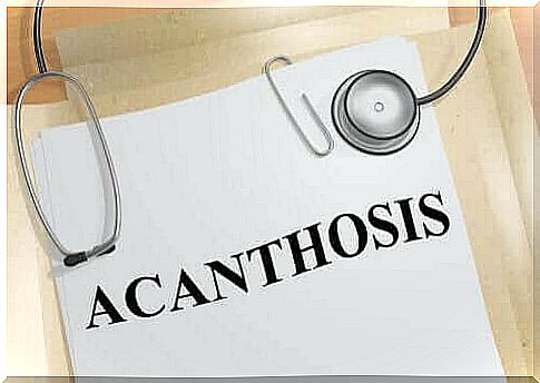 The causes of acanthosis nigricans