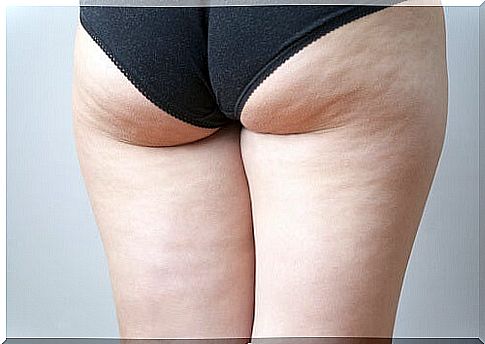 Which gymnastics for cellulite?